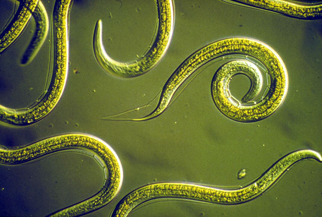 pinworm červy z lidského těla
